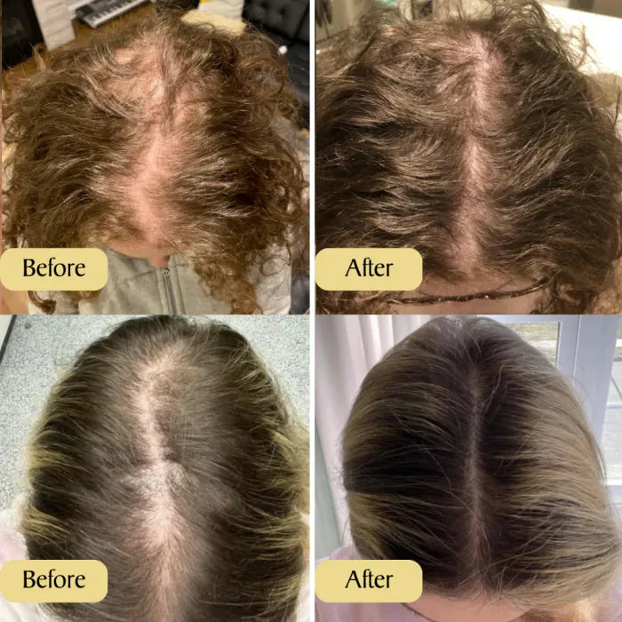 Houdini Natural Vegan Hair Growth Oil V2